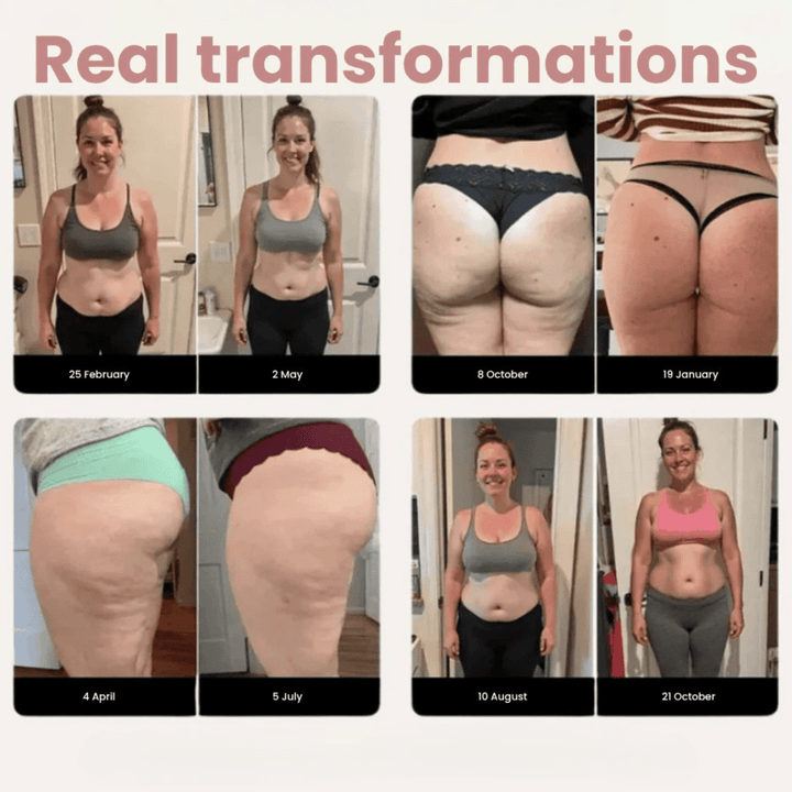 Sélène – Anti-Cellulite Sculpting Leggings